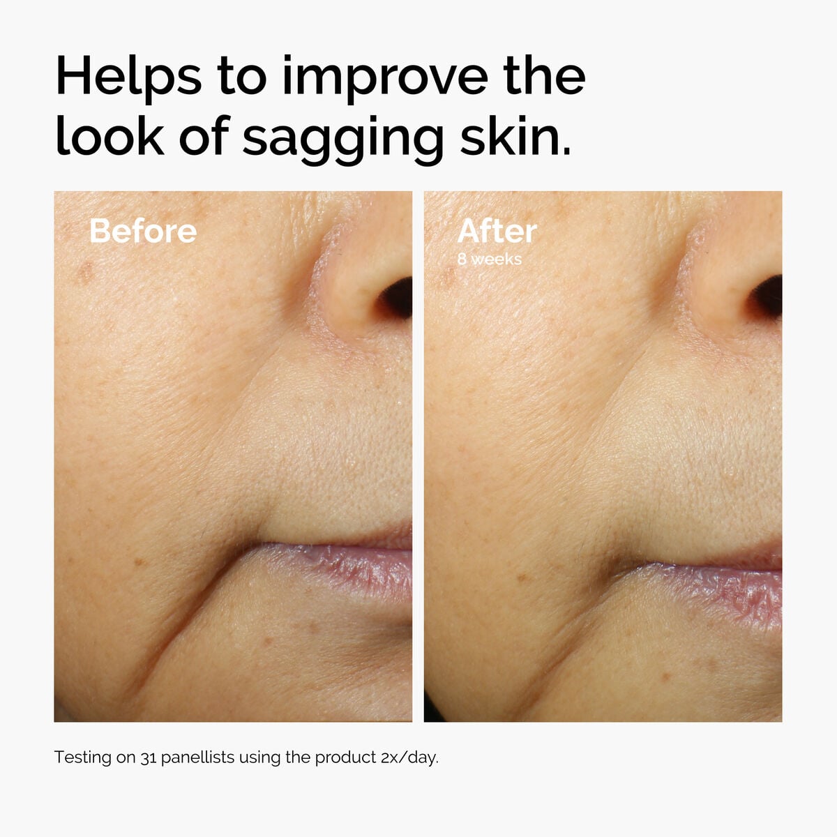 caffeine-3-escin-1-face-serum-o3 ord-caffeine-3pct-escin-1pct-face-serum-before-after-sagging.jpg