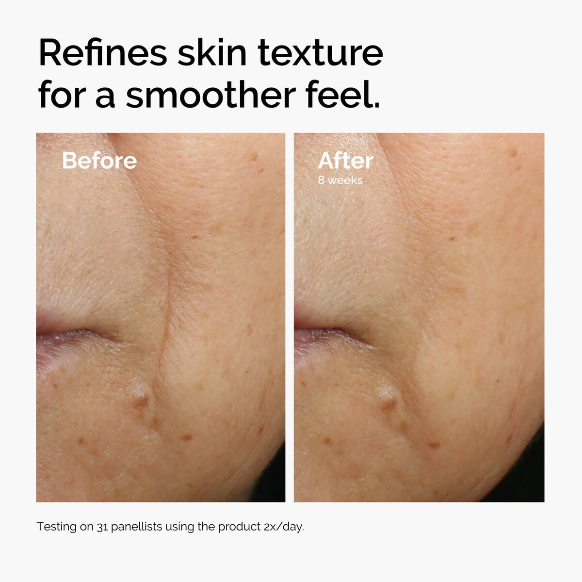 caffeine-3-escin-1-face-serum-o3 ord-caffeine-3pct-escin-1pct-face-serum-before-after-texture.jpg