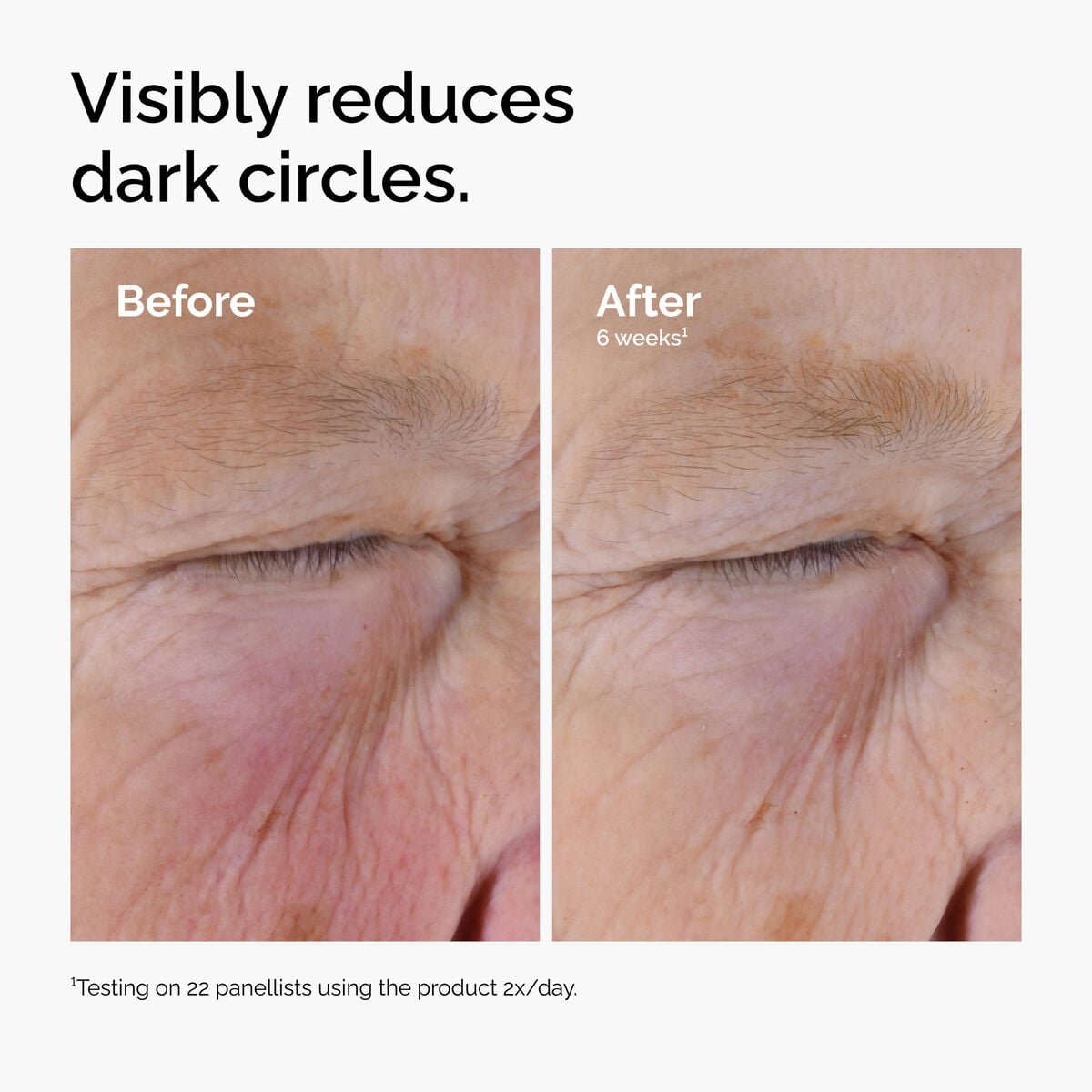caffeine-solution-5-egcg-eye-serum-w1 ord-caffeine-solution-egcg-dark-circles-before-after.jpg