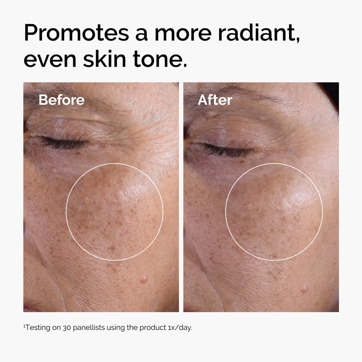 glycolic-acid-7-exfoliating-toner-u5 ord-glycolic-before-after-radiance.jpg