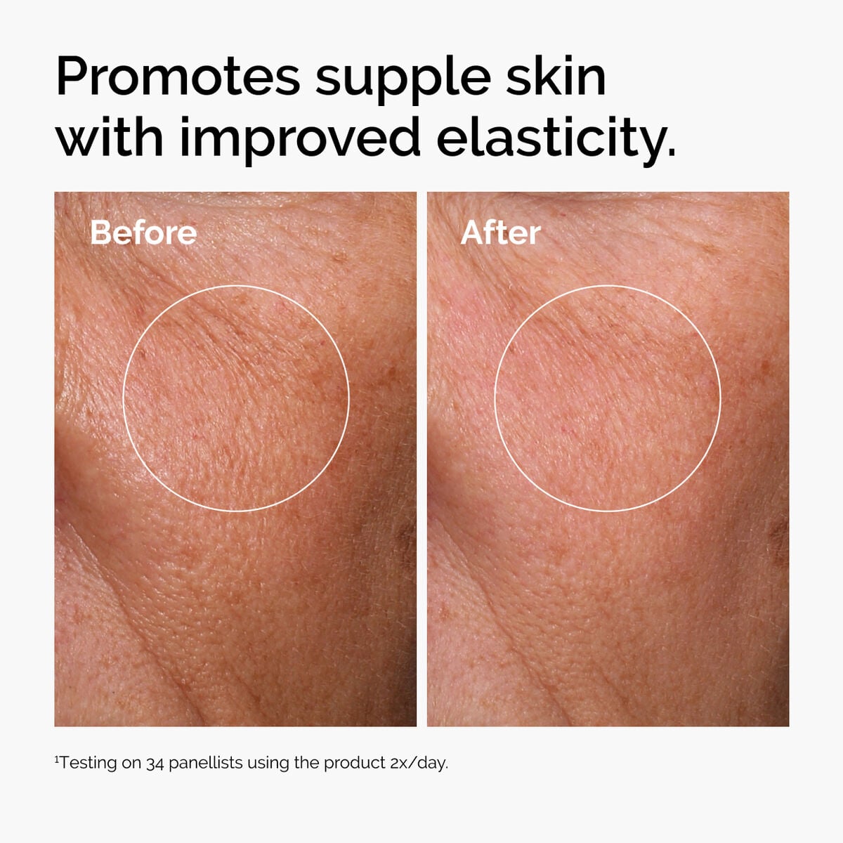 hyaluronic-acid-2-b5-with-ceramides-q6 ord-hyaluronic-acid-2pct-b5-hydrating-serum-before-after-elasticity.jpg
