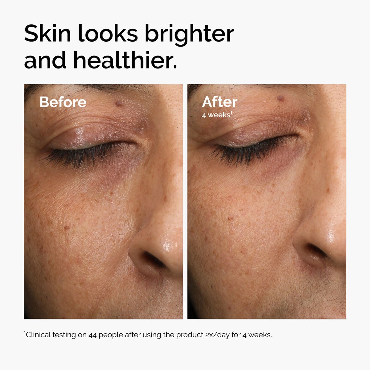 multi-antioxidant-radiance-serum-a7 ord-mars-before-after-healthy.jpg
