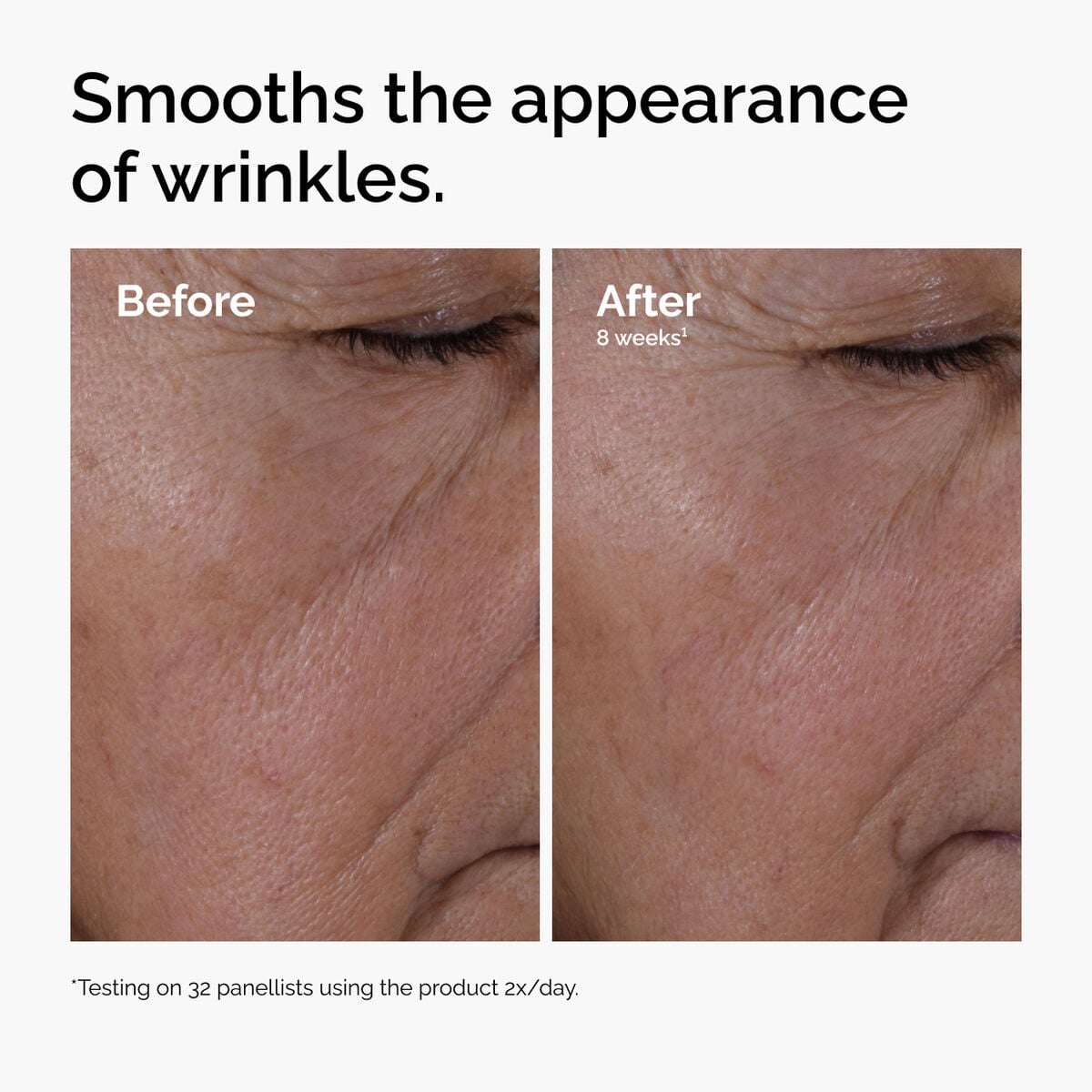 multi-peptide-ha-serum-x0 ord-multi-peptide-ha-serum-wrinkles-before-after.jpg