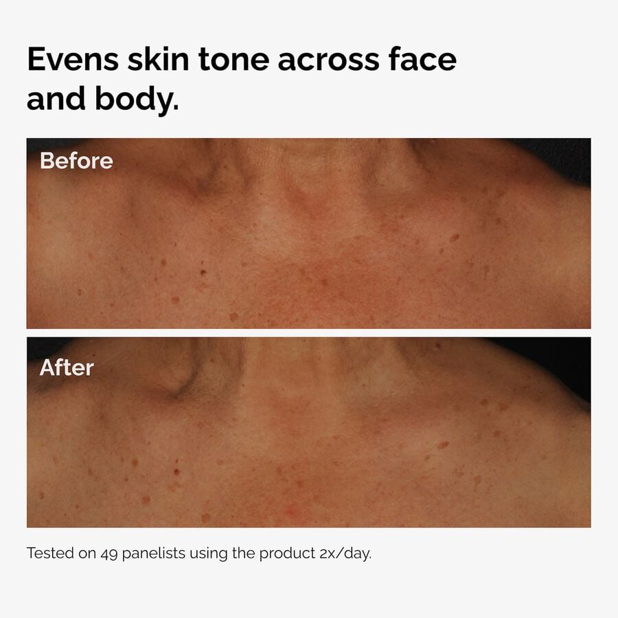 the-body-care-collection-w0 ord-niacinamide-face-body-serum-before-after-even-tone-graphic.jpg