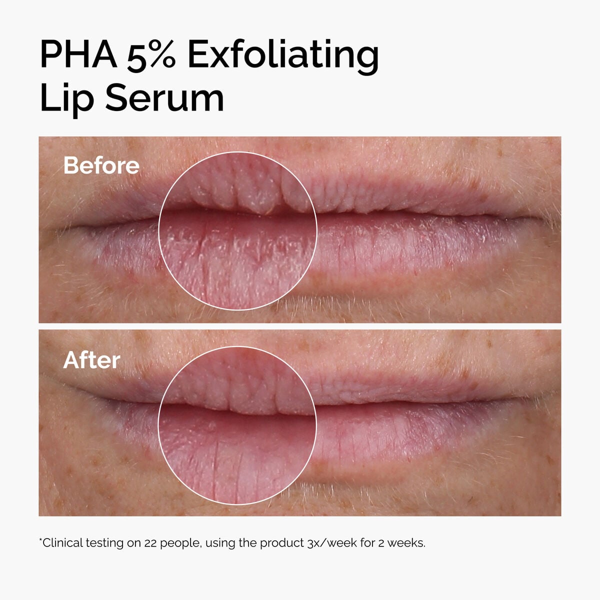 pha-5-exfoliating-lip-serum-u1 ord-pha-5pct-lip-exfoliating-serum-before-after.jpg