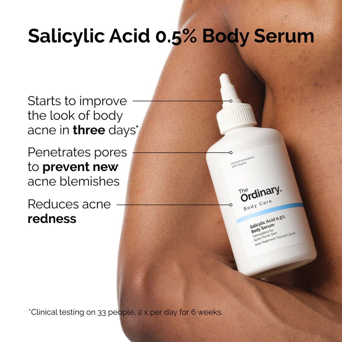 salicylic-acid-0-5-body-serum-y1 ord-salicylic-05-body-serum-otc-benefits-infographic.jpg